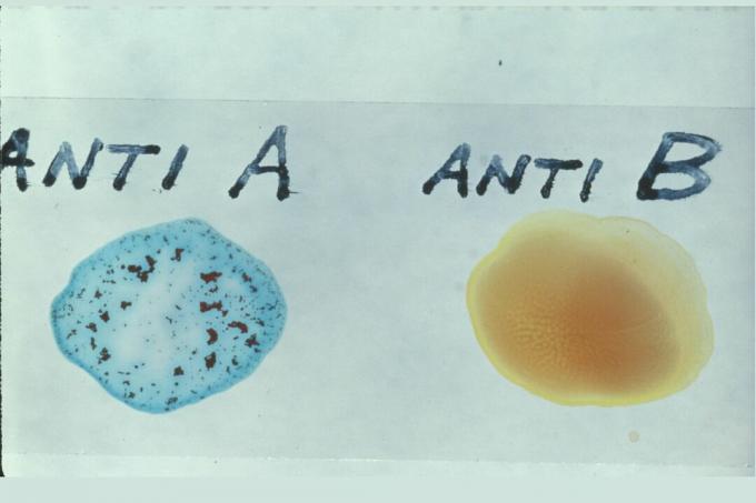 Aglutinatsiooni A-tüüpi veri